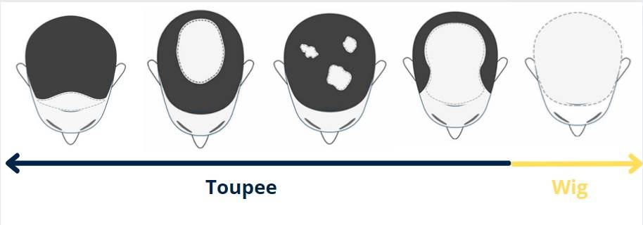 Differences between a toupee and a hair system